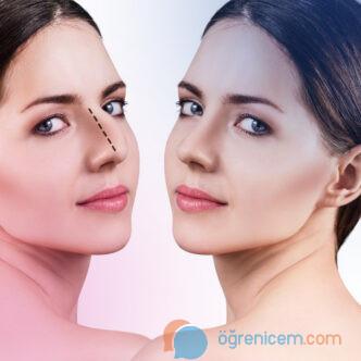 Devlet Hastanelerinde Burun Estetiği