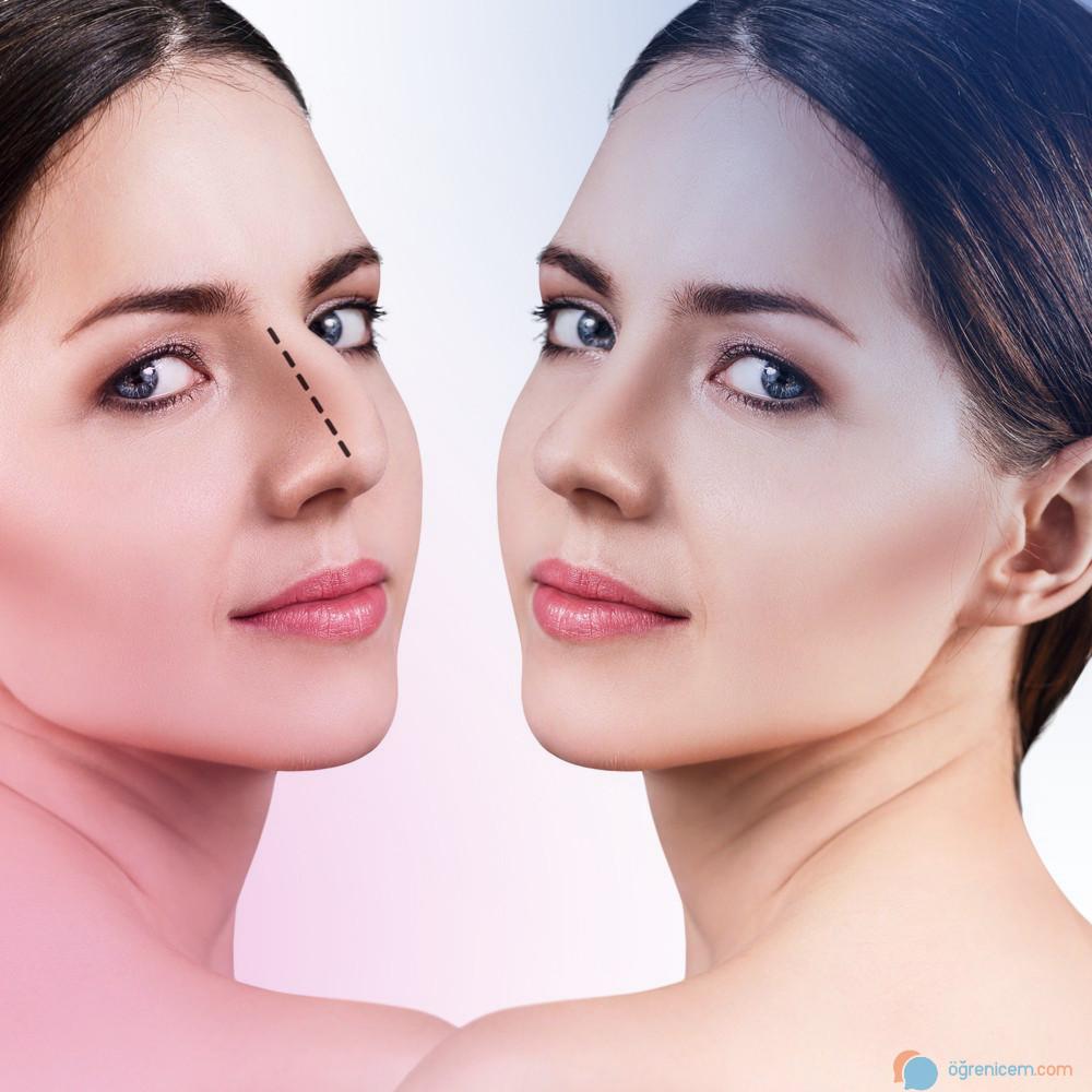 Devlet Hastanelerinde Burun Estetiği